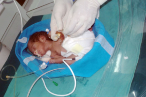 neonatal, NICU