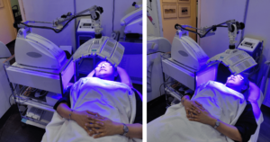 ergo arm omnilux operation